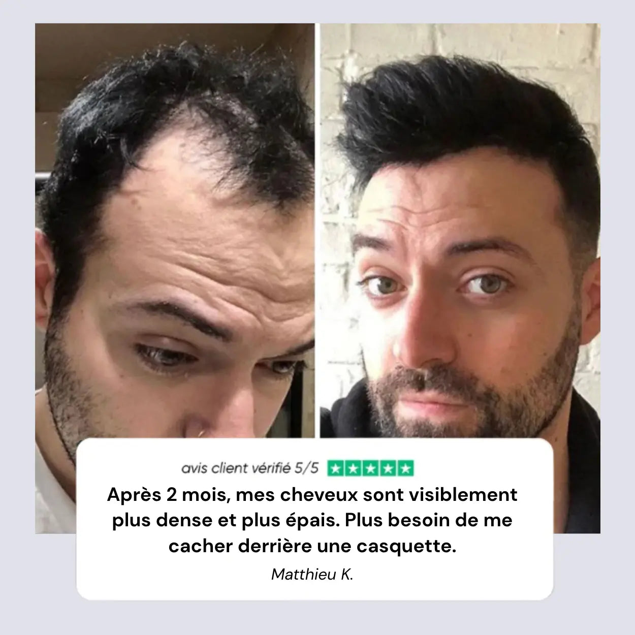 Rolivea™ Système de Réveil Folliculaire