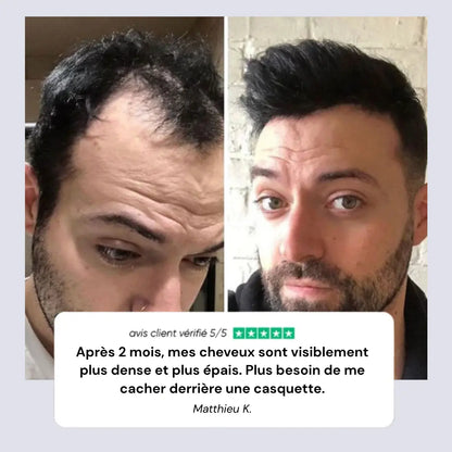 Rolivea™ Système de Réveil Folliculaire