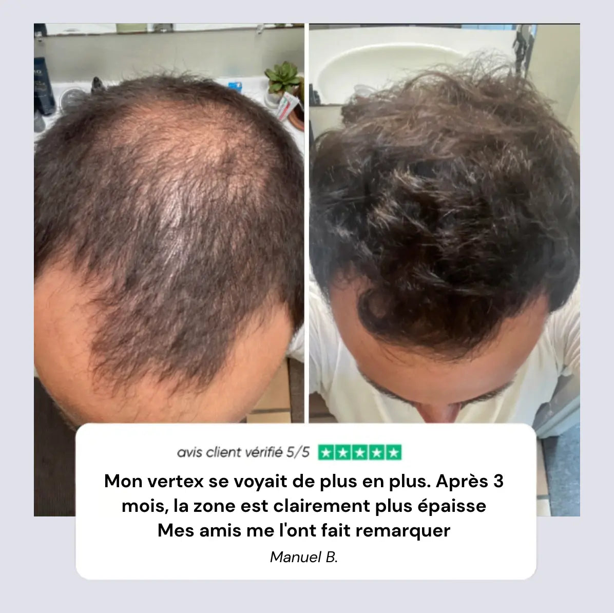 Rolivea™ Système de Réveil Folliculaire