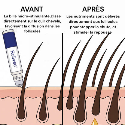 Rolivea™ Système de Réveil Folliculaire